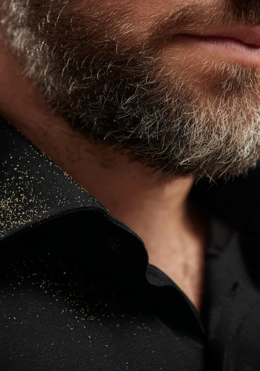 Close-up of a man with beard flakes on shirt, showing beard itch and dry skin problems with normal skincare.